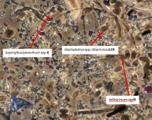 Mould Spores and other particulates at 400x magnification